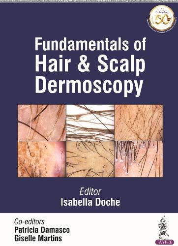 Паперова книга «Fundamentals of Hair and Scalp Dermoscopy», авторів Жизель Мартінс, Ізабелла Дош, Патриція Дамаско - фото №1