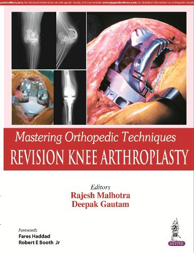 Паперова книга «Mastering Orthopedic Techniques: Revision Knee Arthroplasty», авторів Діпак Гаутам, Раджеш Малхотра - фото №1