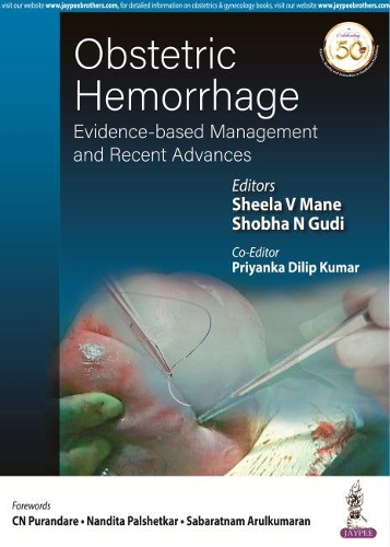 Паперова книга «Obstetric Hemorrhage: Evidence-based Management and Recent Advances», авторів Пріянка Діліп Кумар, Шила Ві Мане, Шобха Н Гуді - фото №1