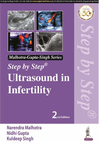 Паперова книга «Step by Step Ultrasound in Infertility», авторів Кулдіп Сінгх, Нарендра Малхотра, Нідхі Гупта - фото №1