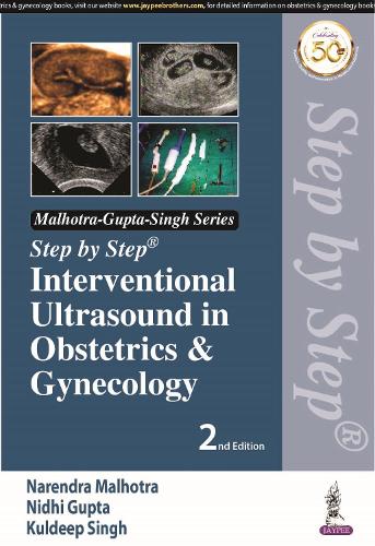 [object Object] «Step by Step Interventional Ultrasound in Obstetrics and Gynecology», авторов Кулдип Сингх, Нарендра Мальхотра, Нехарика Мальхотра Бора, Нидхи Гупта - фото №1