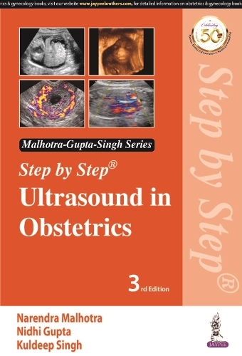 [object Object] «Step by Step Ultrasound in Obstetrics», авторов Нарендра Мальхотра, Нидхи Гупта, Ришаб Бора - фото №1