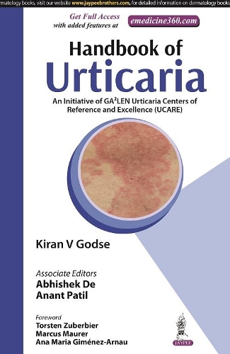 Бумажная книга «Handbook of Urticaria: An Initiative of GA2LEN Urticaria Centers of Reference and Excellence (UCARE)», авторов Абхишек Де, Анант Патил, Киран В Годсе - фото №1