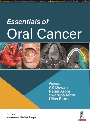 Паперова книга «Essentials of Oral Cancer», авторів А.К. Деван, Раджан Арора, Сварупа Мітра, Уллас Батра - фото №1