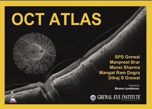 Бумажная книга «OCT Atlas», авторов Дилрадж С Грюал, Мангат Рам Догра, Манприт Брар, Манси Шарма, СПС Грюал - фото №1