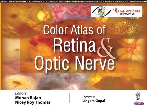 Паперова книга «Color Atlas of Retina & Optic Nerve», авторів Мохан Раджан, Нікі Рой Томас - фото №1