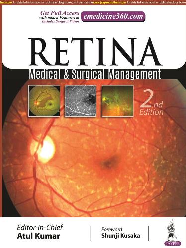 Паперова книга «Retina: Medical & Surgical Management», автор Атул Кумар - фото №1
