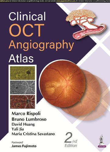 Паперова книга «Clinical OCT Angiography Atlas», авторів Бруно Лумброзо, Девід Хуанг, Марко Рісполі, Марія Крістіна Савастано, Ялі Цзя - фото №1