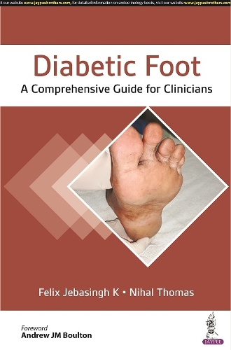 Бумажная книга «Diabetic Foot: A Comprehensive Guide for Clinicians», авторов Феликс Джебасингх К, Нихал Томас - фото №1