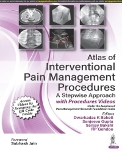 Бумажная книга «Atlas of Interventional Pain Management Procedures: A Stepwise Approach», авторов Дваркадас К. Бахети, РП Гехду, Санджай Бакши, Санджива Гупта - фото №1
