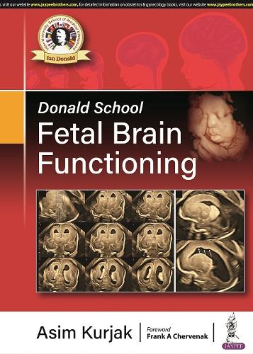 Паперова книга «Donald School Fetal Brain Functioning», автор Асім Курджак - фото №1