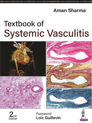 Бумажная книга «Textbook of Systemic Vasculitis», автор Аман Шарма - фото №1