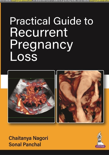 Бумажная книга «Practical Guide to Recurrent Pregnancy Loss», авторов Чайтанья Нагори, Сонал Панчал - фото №1