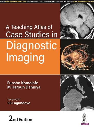 Паперова книга «A Teaching Atlas of Case Studies in Diagnostic Imaging», авторів Фуншо Комолафе, М Харун Данія - фото №1