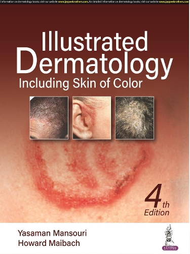 Бумажная книга «Illustrated Dermatology: Including Skin of Colour», авторов Говард Мейбах, Ясаман Мансури - фото №1