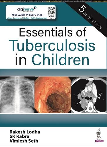 Бумажная книга «Essentials of Tuberculosis in Children», авторов Ракеш Лодха, СК Кабра, Вимлеш Сет - фото №1
