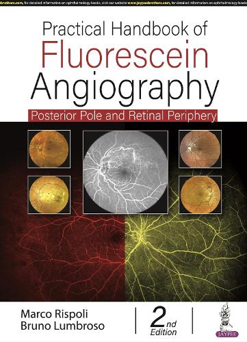 [object Object] «Practical Handbook of Fluorescein Angiography: Posterior Pole and Retinal Periphery», авторів Бруно Лумброзо, Марко Рісполі - фото №1