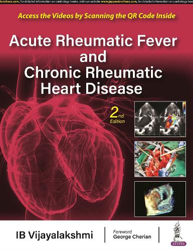Паперова книга «Acute Rheumatic Fever and Chronic Rheumatic Heart Disease», автор І. Б. Віджаялакшмі - фото №1