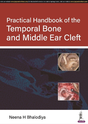 Паперова книга «Practical Handbook of the Temporal Bone and Middle Ear Cleft», автор Ніна Х. Бхалодія - фото №1