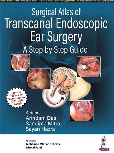 Паперова книга «Surgical Atlas of Transcanal Endoscopic Ear Surgery: A Step by Step Guide», авторів Аріндам Дас, Сандіпта Мітра, Саян Хазра - фото №1