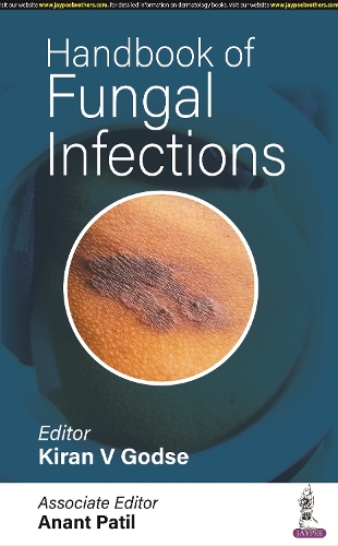 Паперова книга «Handbook of Fungal Infections», авторів Анант Патіл, Кіран В. Годсе - фото №1