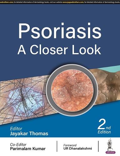 Бумажная книга «Psoriasis: A Closer Look», авторов Джаякар Томас, Парималам Кумар - фото №1