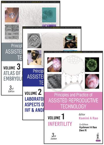 Бумажная книга «Principles and Practice of Assisted Reproductive Technology: Three Volume Set», авторов Деви Р, Камини А Рао, Вишнави А Рао - фото №1