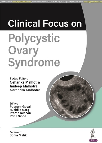 Бумажная книга «Clinical Focus on Polycystic Ovary Syndrome», авторов Джайдип Малхотра, Нарендра Мальхотра, Нехарика Мальхотра - фото №1