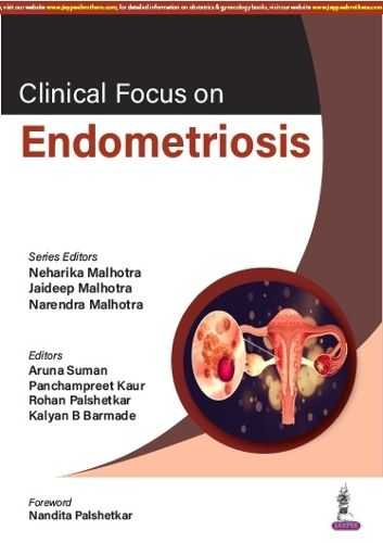 Бумажная книга «Clinical Focus on Endometriosis», авторов Джайдип Малхотра, Нарендра Мальхотра, Нехарика Мальхотра - фото №1