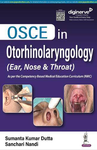 Паперова книга «OSCE in Otorhinolaryngology: (Ear, Nose & Throat)», авторів Санчарі Нанді, Суманта Кумар Дутта - фото №1