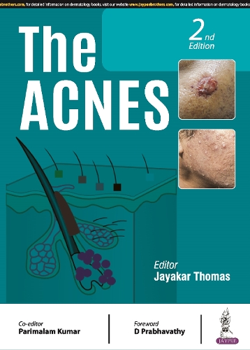 Паперова книга «The Acnes», авторів Джаякар Томас, Парімалам Кумар - фото №1