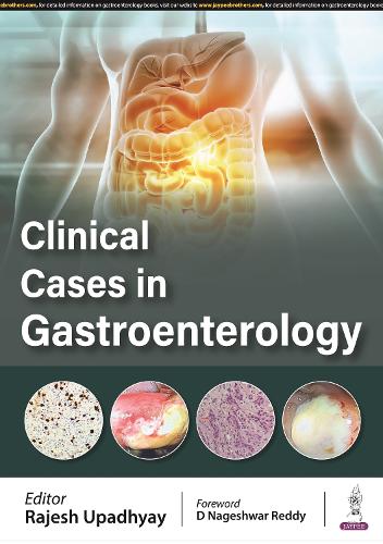 Паперова книга «Clinical Cases in Gastroenterology», автор Раджеш Упадхьяй - фото №1