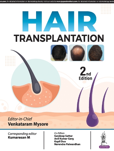 Бумажная книга «Hair Transplantation», автор Венкатарам Майсур - фото №1