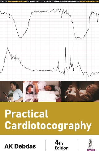 Паперова книга «Practical Cardiotocography», автор АК Дебдас - фото №1