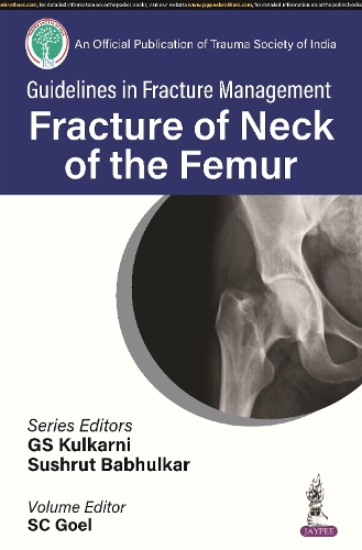 Paper book «Guidelines in Fracture Management: Fracture of the Neck of the Femur», authors GS Kulkarni, SC Goel, Sushrut Babhulkar - фото №1