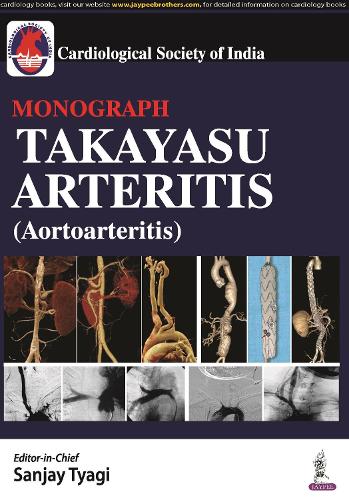 Паперова книга «Takayasu Arteritis (Aortoarteritis)», автор Джордж Джозеф - фото №1