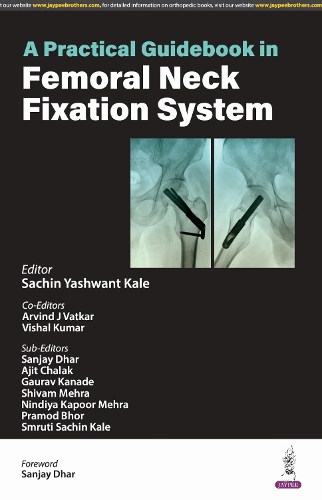 Паперова книга «A Practical Guidebook in Femoral Neck Fixation System», авторів Арвінд Дж. Ваткар, Сачин Яшвант Кале, Вішал Кумар - фото №1