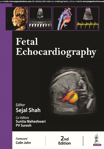 Паперова книга «Fetal Echocardiography», авторів Седжал Шах, Суніта Махешварі - фото №1