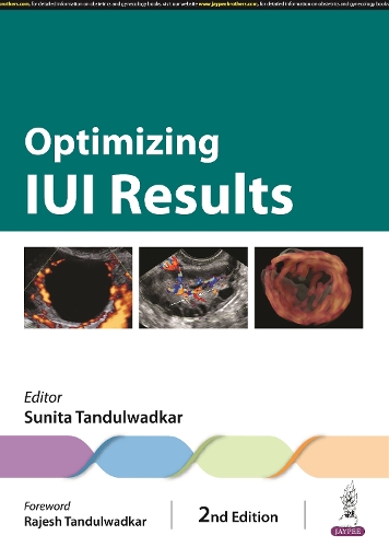 Паперова книга «Optimizing IUI Results», автор Суніта Тандулвадкар - фото №1