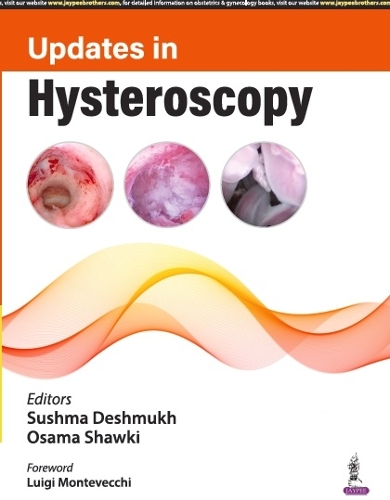 Бумажная книга «Updates in Hysteroscopy», авторов Усама Шауки, Сушма Дешмукх - фото №1