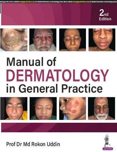 Бумажная книга «Manual of Dermatology in General Practice», автор Рокон Уддин - фото №1