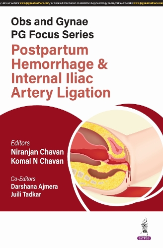 Paper book «Obs and Gynae PG Focus Series: Postpartum Hemorrhage and Internal Iliac Artery Ligation», author Niranjan Chavan - фото №1