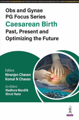 Paper book «Obs and Gynae PG Focus Series: Caesarean Birth: Past, Present and Optimizing the Future», author Niranjan Chavan - фото №1