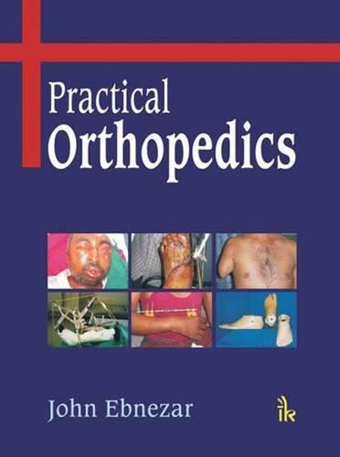 Паперова книга «Practical Orthopedics», автор Джон Ебнезар - фото №1