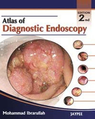 Бумажная книга «Atlas of Diagnostic Endoscopy», автор Мохаммад Ибрарулла - фото №1