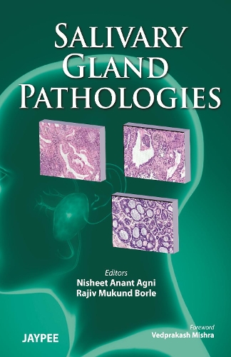 Бумажная книга «Salivary Gland Pathologies», авторов Нишит Анант Агни, Раджив Мукунд Борле - фото №1