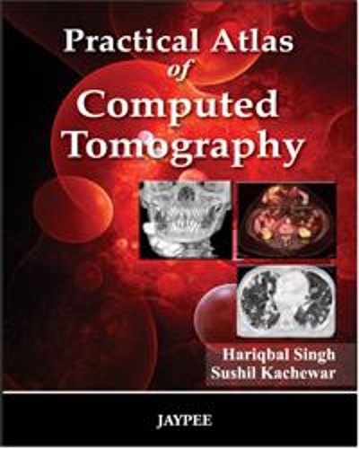 Бумажная книга «Practical Atlas of Computed Tomography», авторов Харикбал Сингх, Сушил Качевар - фото №1