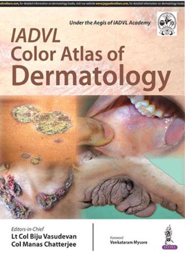 Бумажная книга «IADVL Color Atlas of Dermatology», авторов Биджу Васудеван, Манас Чаттерджи - фото №1