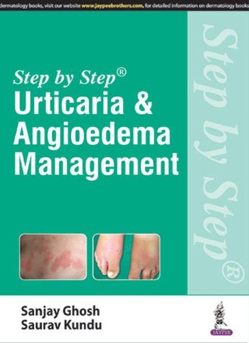 Бумажная книга «Step by Step: Urticaria & Angioedema Management», авторов Санджай Гхош, Саурав Кунду - фото №1