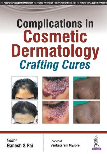Бумажная книга «Complications in Cosmetic Dermatology: Crafting Cures», автор Ганеш С. Пай - фото №1